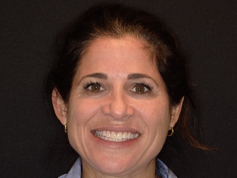 A smiling woman with short hair, wearing a blue top, against a black background.